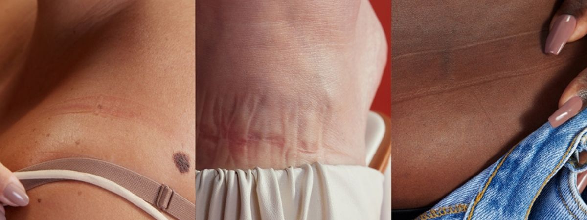 Boticário traz as marcas da rotina intensa na pele em nova campanha